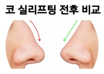 24까페거리의원
