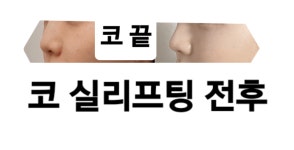 24까페거리의원