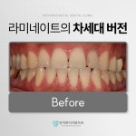 안아픈디지털치과의원