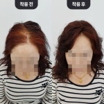 그랜드가발에스엠피 | 그랜드가발 본점