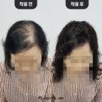 그랜드가발에스엠피 | 그랜드가발 본점