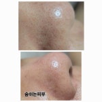 숨쉬는피부살롱