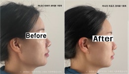 어나더근본 천안본점