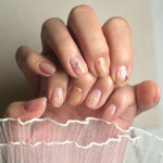 하꼼네일 파고드는발톱 문제성발톱 발각질