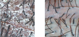 닥터모락 광주상무점