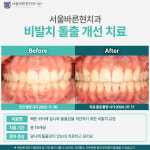 서울바른현치과의원