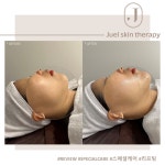 주엘스킨테라피