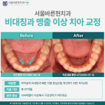 서울바른현치과의원