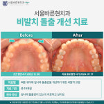 서울바른현치과의원