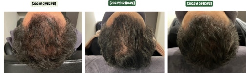 닥터모락 광주상무점