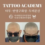 에스지스칼프