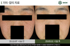 스노우의원 대전둔산점