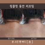 본스킨앤바디