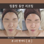 본스킨앤바디