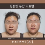 본스킨앤바디