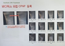 스킨톡에스테틱