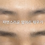 아르떼스칼프