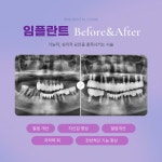 온아치과의원 천호역점