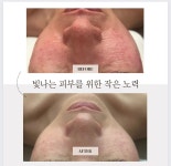 더예쁜날