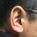 대명보청기