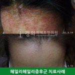 경희피레토한의원
