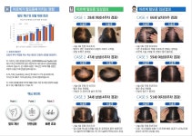 잠실 비엘에스의원