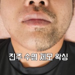 단미