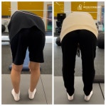 물리치료사의바디포스쳐PT