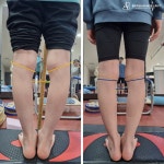 물리치료사의바디포스쳐PT