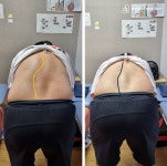 물리치료사의바디포스쳐PT