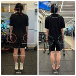 물리치료사의바디포스쳐PT