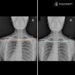 물리치료사의바디포스쳐PT