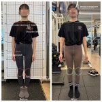 물리치료사의바디포스쳐PT