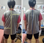 물리치료사의바디포스쳐PT