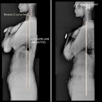 물리치료사의바디포스쳐PT