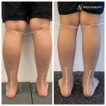 물리치료사의바디포스쳐PT