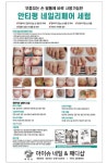 아이슈네일