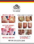 LCN라운지 충북영동점 허니네일