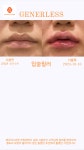 제너리스의원 부천점