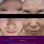 희 : 스킨케어