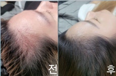 채움솔루션