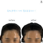도트비