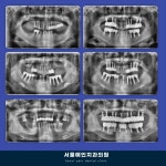 서울예인치과의원