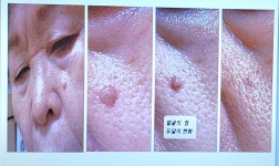 윤앤허브EMS