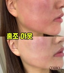 꼬모에스테틱(comoaesthetic) | 꼬모에스테틱 광주수완점