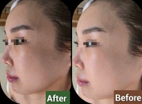 숨호흡하는에스테틱 부산서면전포동점