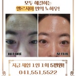 엘르시아피부관리