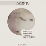 천안왁싱 뷰티앤케이