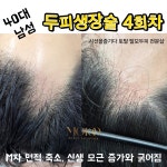 시선을즐기다 토탈 탈모 두피커버 전문샵