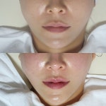 셀포랩 라라뷰티